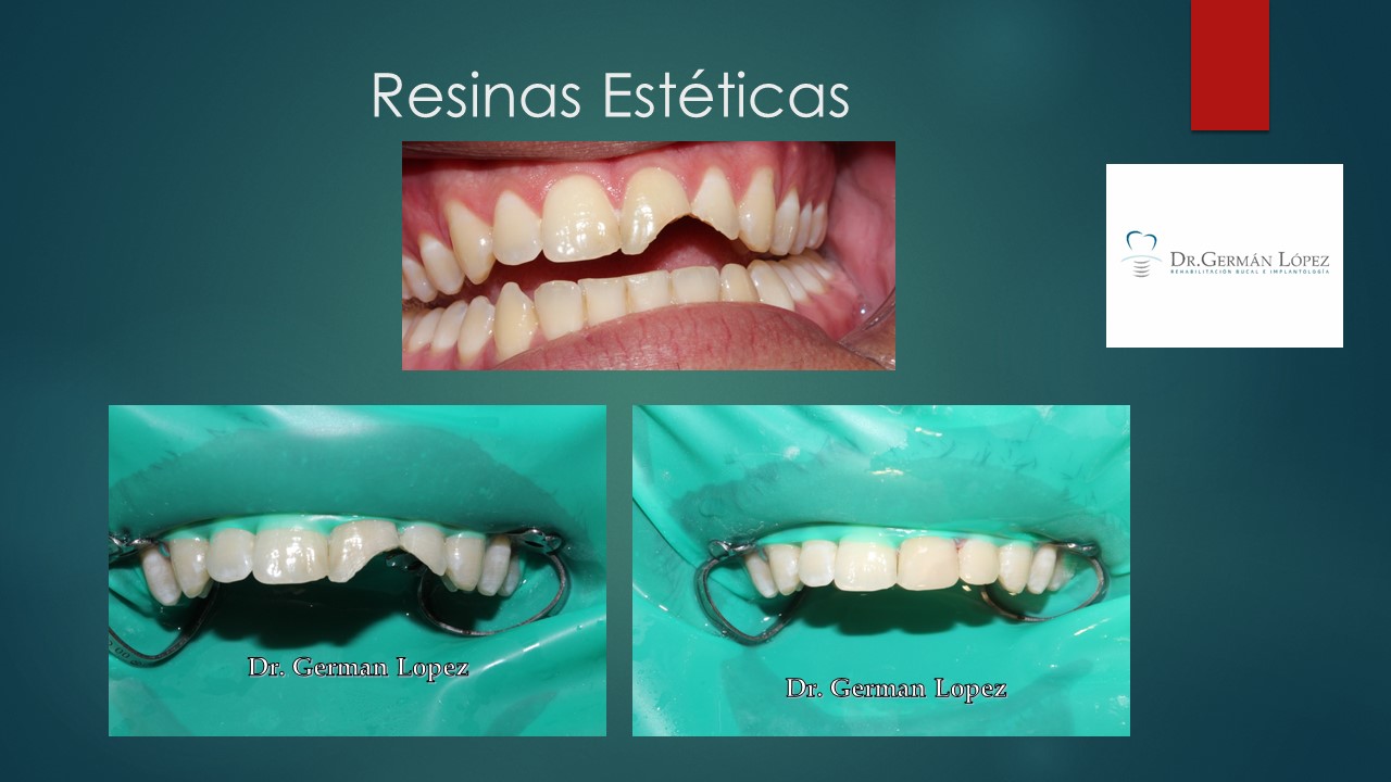 Germán López Álvarez